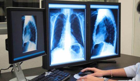 Olímpia investe em digitalização de exames para modernizar o acesso aos resultados